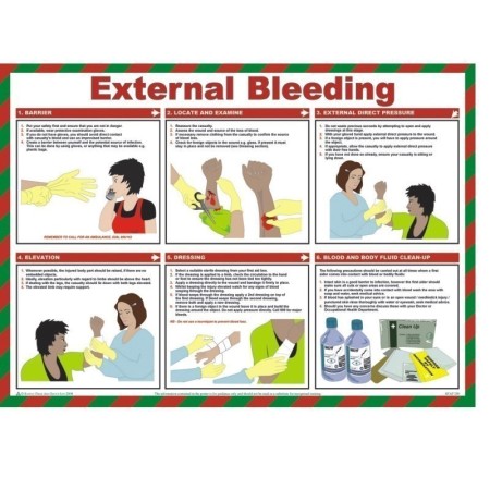 External bleeding first aid guidance poster