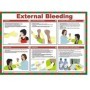 External bleeding first aid guidance poster
